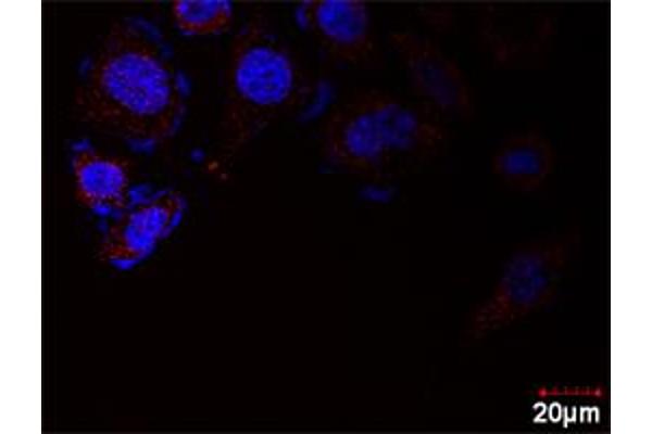 E2F2 & E2F1 Protein Protein Interaction Antibody Pair
