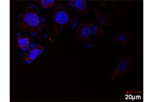 Image no. 6 for E2F2 & E2F1 Protein Protein Interaction Antibody Pair (ABIN1340332)