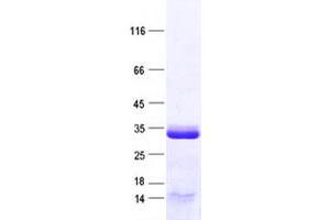 Image no. 1 for Cyclin Y-Like 1 (CCNYL1) protein (His tag) (ABIN2713328)
