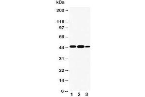 Western blot testing of INDOL1 antibody and Lane 1:  A549;  2: human placenta;  3: A431 cell lysate.