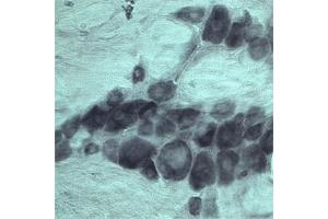 Image no. 3 for anti-Vacuolar Protein Sorting 45 (VPS45) antibody (ABIN351328)