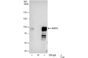 Image no. 3 for anti-SRY (Sex Determining Region Y)-Box 13 (SOX13) (Center) antibody (ABIN2855783)