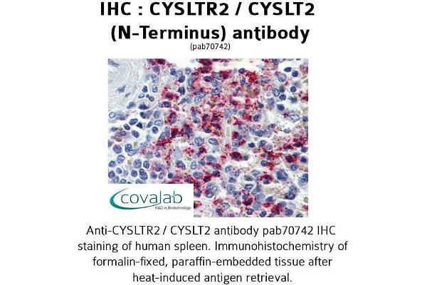 CasLTR2 Antikörper  (N-Term)