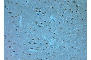 Image no. 2 for anti-Calcium Channel, Voltage-Dependent, gamma Subunit 2 (CACNG2) (C-Term) antibody (ABIN571657)