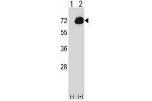 Image no. 1 for anti-CTP Synthase II (CTPS2) (AA 449-479), (C-Term) antibody (ABIN951729)