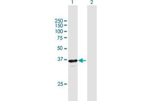 Image no. 1 for anti-Retinitis Pigmentosa 2 (X-Linked Recessive) (RP2) (AA 1-350) antibody (ABIN948413)