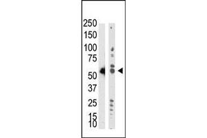 Image no. 1 for anti-tRNA Aspartic Acid Methyltransferase 1 (TRDMT1) (AA 346-375) antibody (ABIN387859)