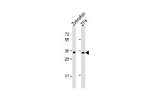 Image no. 3 for anti-Guanine Nucleotide Binding Protein (G Protein), beta Polypeptide 1 (GNB1) (AA 1-30), (N-Term) antibody (ABIN1881379)