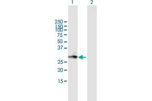 anti-Leucine Rich Repeat Containing 61 (LRRC61) (AA 1-259) antibody