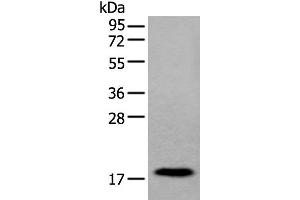 Western blot analysis of Human urinary bladder tissue lysate using MYL12B Polyclonal Antibody at dilution of 1:250