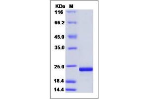 Image no. 1 for Fibroblast Growth Factor 7 (FGF7) (AA 32-194) protein (His tag) (ABIN2002361)