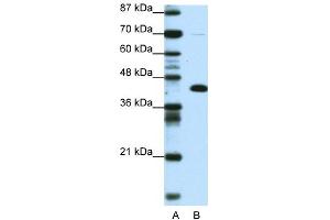 Image no. 1 for anti-Zinc Finger and BTB Domain Containing 25 (ZBTB25) (Middle Region) antibody (ABIN2777988)