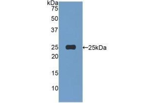 Afamin antibody  (AA 22-210)
