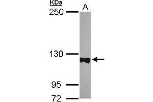 Image no. 1 for anti-Protein Tyrosine Phosphatase G1 (PTPN12) (N-Term) antibody (ABIN2855422)