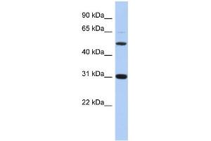 Image no. 1 for anti-Peptidase Inhibitor 16 (PI16) (Middle Region) antibody (ABIN2786278)