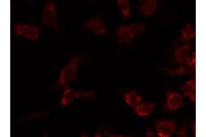 anti-Mitochondrial Ribosomal Protein L20 (MRPL20) (C-Term) antibody