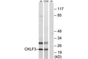 Image no. 1 for anti-CKLF-Like MARVEL Transmembrane Domain Containing 3 (CMTM3) (AA 1-50) antibody (ABIN2890221)