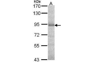 Image no. 2 for anti-Dipeptidyl-Peptidase 8 (DPP8) (Internal Region) antibody (ABIN2854505)