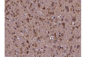 Image no. 2 for anti-Cell Division Cycle 37 Homolog (S. Cerevisiae) (CDC37) (AA 1-379) antibody (ABIN2691733)