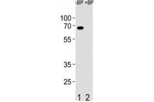 Image no. 1 for anti-Ets Variant 5 (ETV5) (AA 8-36) antibody (ABIN3030878)