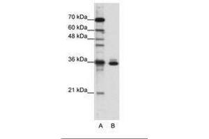 Image no. 3 for anti-Musashi Homolog 2 (MSI2) (AA 37-86) antibody (ABIN203056)