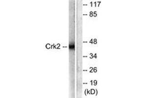 Image no. 1 for anti-V-Crk Sarcoma Virus CT10 Oncogene Homolog (Avian) (CRK) (AA 187-236) antibody (ABIN1532240)
