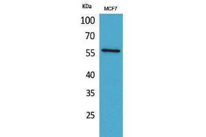 Image no. 1 for anti-Activin A Receptor Type II-Like 1 (ACVRL1) (N-Term) antibody (ABIN3187721)