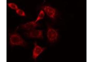 Image no. 2 for anti-Carbonic Anhydrase I (CA1) (Internal Region) antibody (ABIN6260376)