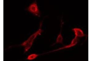 Image no. 3 for anti-Dual Specificity Phosphatase 10 (DUSP10) (Internal Region) antibody (ABIN6257139)