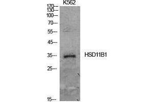 HSD11B1 Antikörper  (Internal Region)