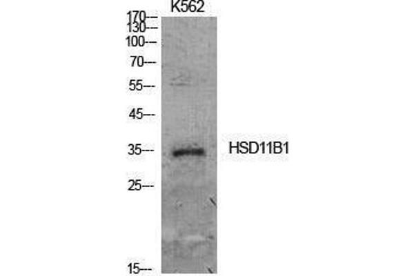 HSD11B1 Antikörper  (Internal Region)