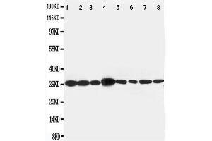 Image no. 5 for anti-LIM and SH3 Protein 1 (LASP1) (AA 16-30), (N-Term) antibody (ABIN3044177)