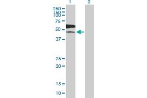 Image no. 1 for anti-Pyruvate Kinase, Liver and RBC (PKLR) (AA 1-574) antibody (ABIN518919)