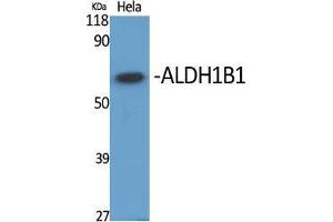Image no. 2 for anti-Aldehyde Dehydrogenase 1 Family, Member B1 (ALDH1B1) (Internal Region) antibody (ABIN3183245)