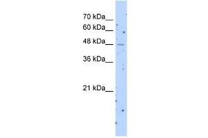 anti-Solute Carrier Family 22 (Organic Cation Transporter), Member 23 (SLC22A23) (Middle Region) antibody