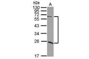 Image no. 1 for anti-Udp-N-Acetyl-alpha-D-Galactosamine:polypeptide N-Acetylgalactosaminyltransferase 9 (GalNAc-T9) (GALNT9) (AA 333-573) antibody (ABIN1498371)