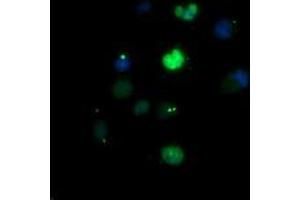Image no. 1 for anti-Early Growth Response 2 (EGR2) (AA 156-476) antibody (ABIN1490983)