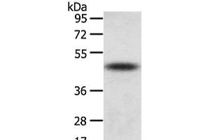 Western Blot analysis of Mouse adrenal gland tissue using TTC23 Polyclonal Antibody at dilution of 1/800