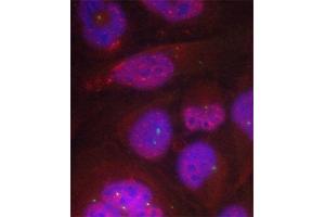 Image no. 2 for anti-Nuclear Factor-kB p65 (NFkBP65) (pSer276) antibody (ABIN1682005)