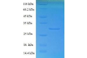 COTL1 Protein (Coactosin-Like Protein) (AA 2-142) (His-SUMO Tag)
