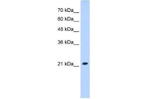 anti-Solute Carrier Family 25 (Mitochondrial Carrier, Brain), Member 14 (SLC25A14) (N-Term) antibody
