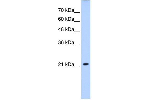 anti-Solute Carrier Family 25 (Mitochondrial Carrier, Brain), Member 14 (SLC25A14) (N-Term) antibody