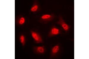 Image no. 1 for anti-Protein Kinase, AMP-Activated, beta 1 Non-Catalytic Subunit (PRKAB1) (N-Term) antibody (ABIN2707328)
