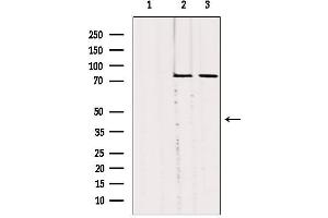 Image no. 3 for anti-Solute Carrier Family 27 (Fatty Acid Transporter), Member 5 (SLC27A5) (Internal Region) antibody (ABIN6258542)