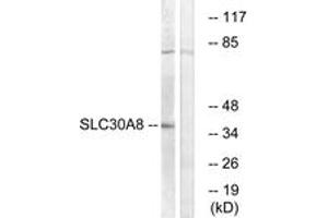 Image no. 1 for anti-Solute Carrier Family 30 (Zinc Transporter), Member 8 (SLC30A8) (AA 171-220) antibody (ABIN1535487)