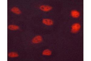 Image no. 3 for anti-Hepatocyte Nuclear Factor 4, alpha (HNF4A) (pSer313) antibody (ABIN6256265)
