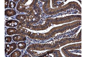 IHC-P Image ARL14 antibody [N1C3] detects ARL14 protein at cytoplasm and membrane in mouse duodenum by immunohistochemical analysis.