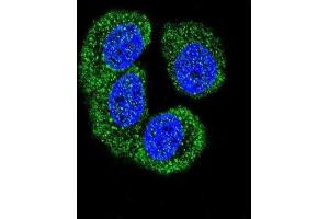 Image no. 2 for anti-Nemo-Like Kinase (NLK) (Thr286) antibody (ABIN3003279)
