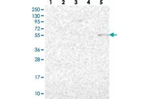 Image no. 1 for anti-Prosaposin-Like 1 (PSAPL1) antibody (ABIN5586293)