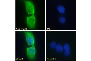 Image no. 4 for anti-Integral Membrane Protein 2B (ITM2B) (Internal Region) antibody (ABIN570955)